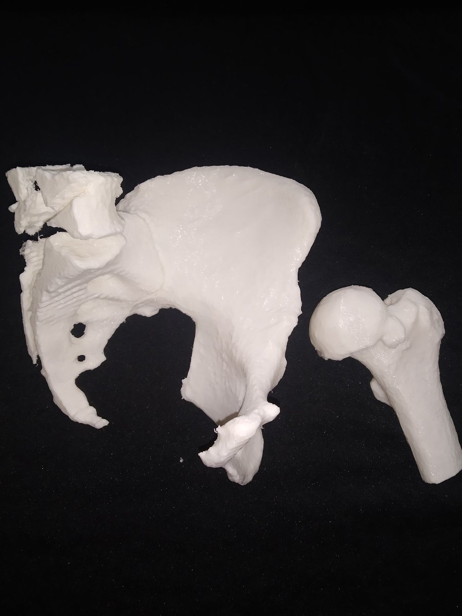 MM3D_'s tweet photo. Nuevo año con nuevos modelos 3D! #3dprinting #impresion3d #3dmodel #hemipelvis #femur #medicaldevices #medicalmodel3d https://t.co/j4hLzIroIP