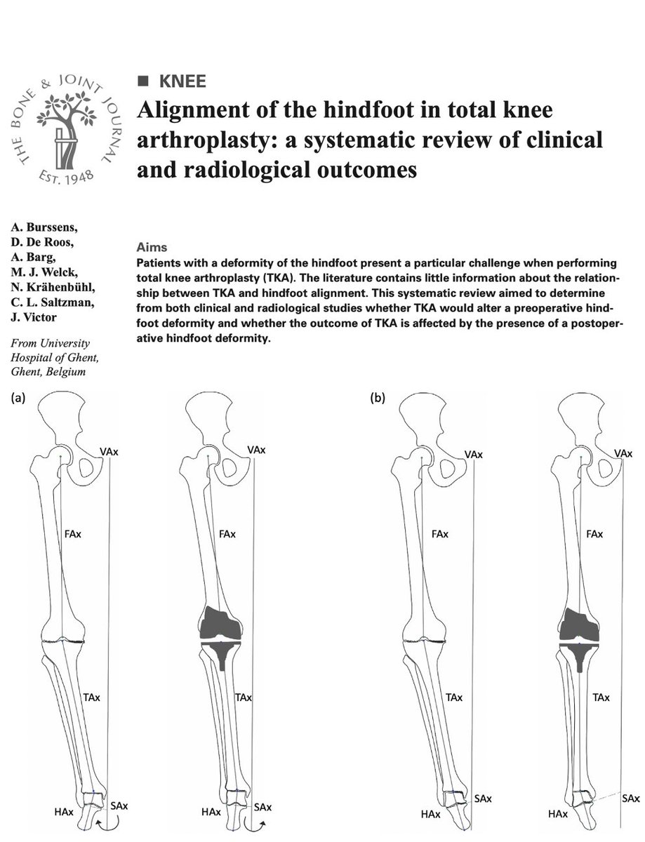 Arne Burssens (@a_burssens) on Twitter photo Knee - and hindfoot alignment are delicately balanced relative to each other. How exactly is your #TKA procedure interfering with this complex interaction? Read it now in our recent systematic review: online.boneandjoint.org.uk/doi/full/10.13β¦ <a href="/BoneJointJ/">The Bone & Joint Journal</a> @RNOHnhs <a href="/OrthoMScUCL/">Orthopaedics MSc UCL</a> <a href="/UofUOrtho/">UofU Department of Orthopeadics</a> @OrthoUZG Knee - and hindfoot alignment are delicately balanced relative to each other. How exactly is your #TKA procedure interfering with this complex interaction? Read it now in our recent systematic review: online.boneandjoint.org.uk/doi/full/10.13β¦ <a href="/BoneJointJ/">The Bone & Joint Journal</a> @RNOHnhs <a href="/OrthoMScUCL/">Orthopaedics MSc UCL</a> <a href="/UofUOrtho/">UofU Department of Orthopeadics</a> @OrthoUZG