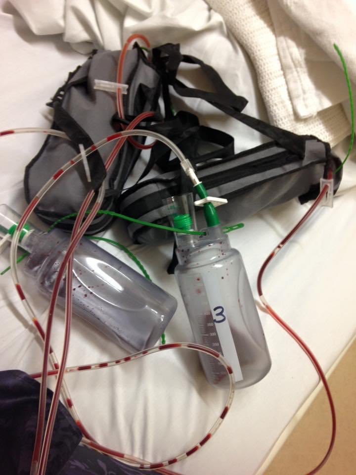 Today marks 5 years since I returned home with this lot, having had a double mastectomy. Shortly, lifesaving treatment like this, and others to do with acute and chronic cancers, mental health situations, kidney and liver complaints etc etc will not be available  #NHS