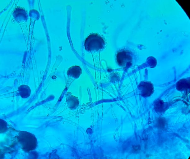 AaMolinaID's tweet photo. Primer Aspergillus spp que aislamos en un 😷 (sin factores de riesgo clásicos) en VEntilación mecánica invasiva por #COVID19 Crítico desde el inicio de la pandemia en nuestro hospital, ¡una rareza! #microbiology #microbiologylab #aspergillus #IdCases https://t.co/Bk3xzXxFCF