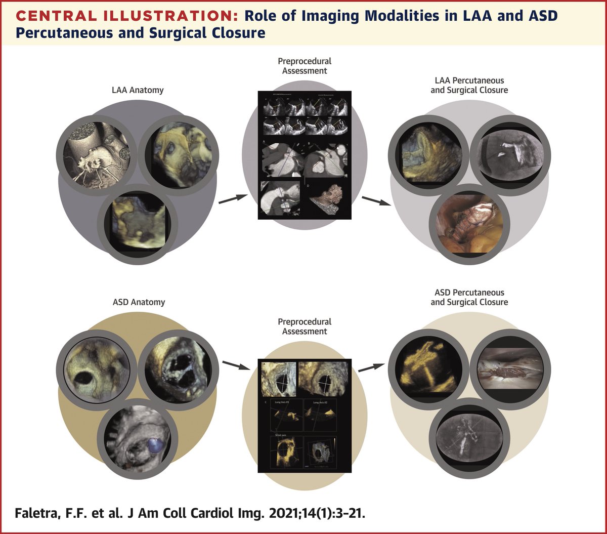 How do you use #cvImaging in planning &amp; procedural guidance of percutaneous or surgical closure of the #LAA &amp; #ASD? A comprehensive approach is outlined in this #JACCIMG state-of-the-art review: bit.ly/399dC5G #echofirst #yesCCT #whyCMR