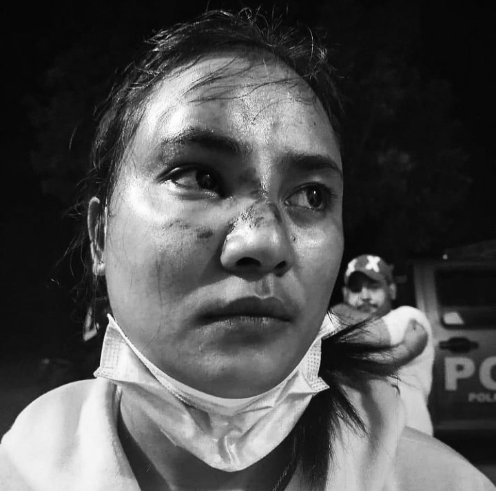 HermanEfTanouf's tweet photo. Razia masker (protokol Covid-19) di Waingapu, Sumba Timur, Nusa Tenggara Timur pada 8 Januari 2020 sekitar pukul 10:00 WITA  'memakan' korban. Adalah seorang perempuan dengan luka di bagian wajah. Ia dipukuli oleh oknum aparat Satpol PP menggunakan kayu.

#RaziaProkesWaingapu https://t.co/rKlOMuSrlK