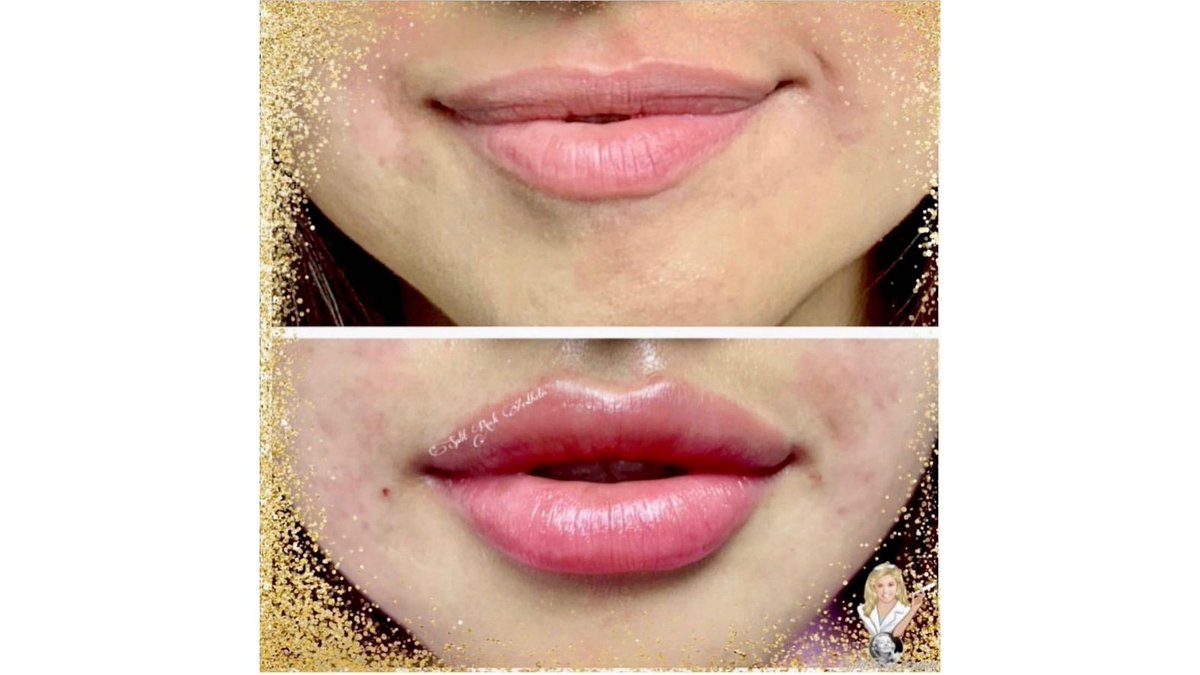 SplitRockAesIns's tweet photo. Get gorgeous lips this New Year! https://t.co/crcBEgPYCg
