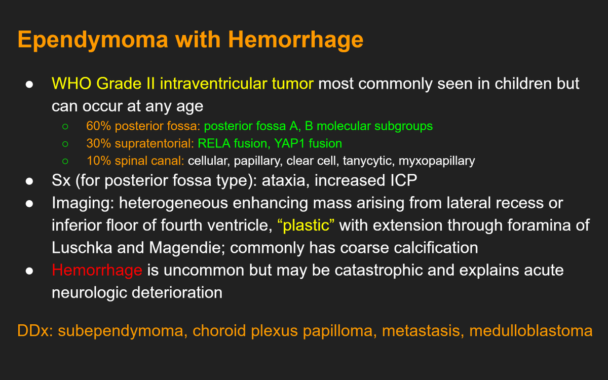 amychenvais's tweet photo. Answer: Ependymoma with intratumoral and intraventricular hemorrhage! Note the lower SWI image that showed layering hemorrhage in occipital horns. Ependymoma is most commonly diagnosed in children (esp posterior fossa subtype) but can certainly occur at any age. https://t.co/TtiqTXF5M4