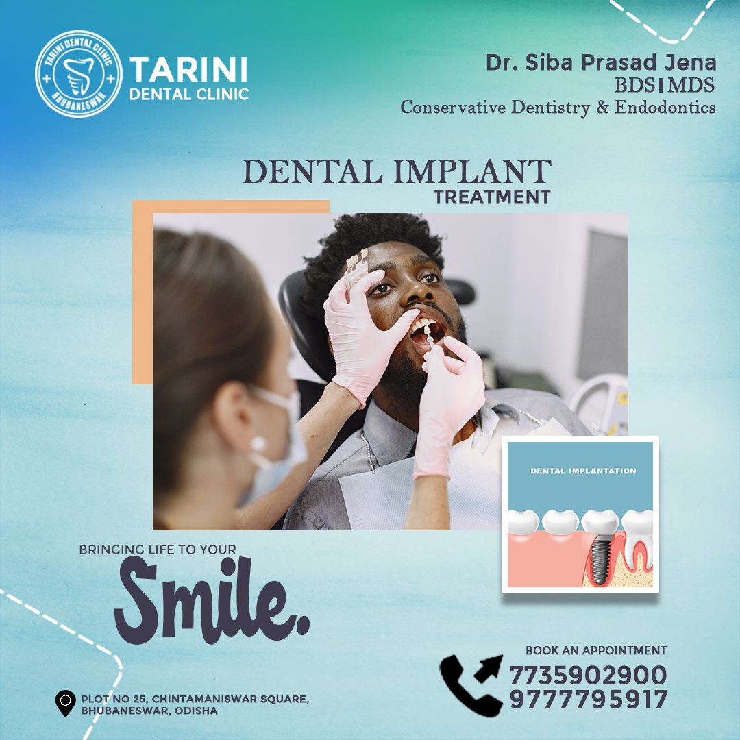 Dental implants are surgically placed in your jawbone, where they serve as the roots of missing teeth.

For Appointment: 📲7735902900 | 📲9777795917

#dentistry #dentalimplants #dentalclinic #dentistrylife #damagedtooth #smile #SmileCare #teethcleaning #dental #Bhubaneswar