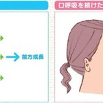 口呼吸を続けた場合の結果が悲惨!悪いことは言わないから鼻呼吸しよう!