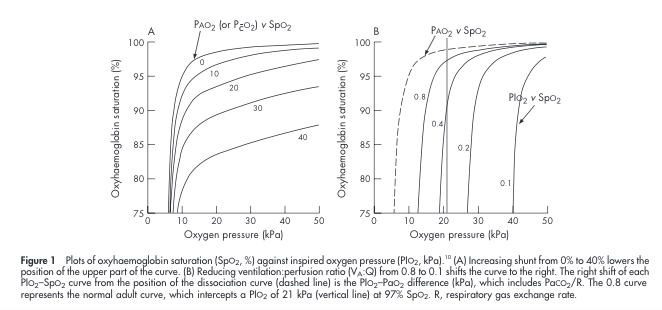 Why limited? 2 key reasons: (1) outcome prone to measurement error (2) value influenced by underlying respiratory support. To elaborate, helpful to review how right-shift derived. Fig is from 2006 paper by  @Boyleem  @StensonBen & others in  @ADC_FN:  https://www.ncbi.nlm.nih.gov/pmc/articles/PMC2672753/pdf/F409.pdf5/