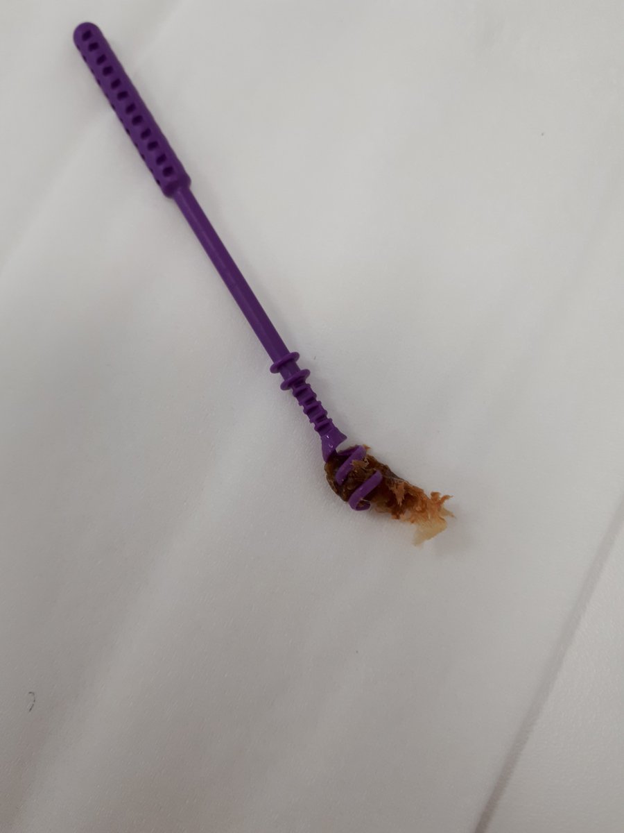 And that is one of the reasons, we are proud to offer the EarWay Pro tool for earwax removal! 

👉justaudiologystuff.com/using-the-earw…

Want to try it out? contact@sanibelsupply.com 

More info at our website:sanibelsupply.com/earway-pro-m-5…