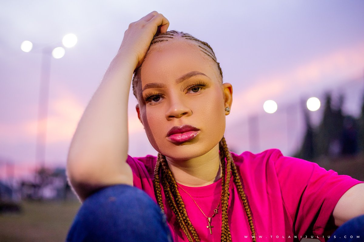 beyond_colours's tweet photo. We Are Made To Stand Firm On Who We Are! Accept Our Uniqueness And Definitely Rule In Our Own Strength... 

Thank you for standing firm and saying Yes to a world BEYOND COLORS! 

Photographed: @IamTolaniJulius 
#albino
#albinism
#beyondcolors
#beyondcolors@3
#loverofallskins https://t.co/s7ilsdBEoi