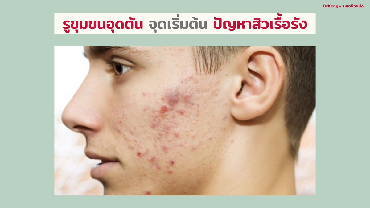 เรื่องของผิว by Kengw tweet media
