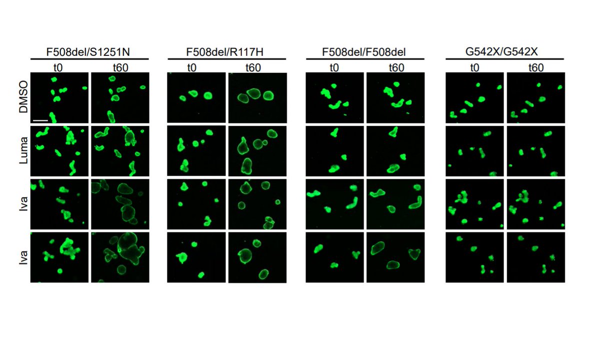 👨‍⚕️ Researchers from <a href="/KU_Leuven/">KU Leuven</a> studied cystic fibrosis transmembrane conductance regulator (CFTR) function in #organoids of subjects with common and rare CFTR mutations.

bit.ly/2L1AoVc