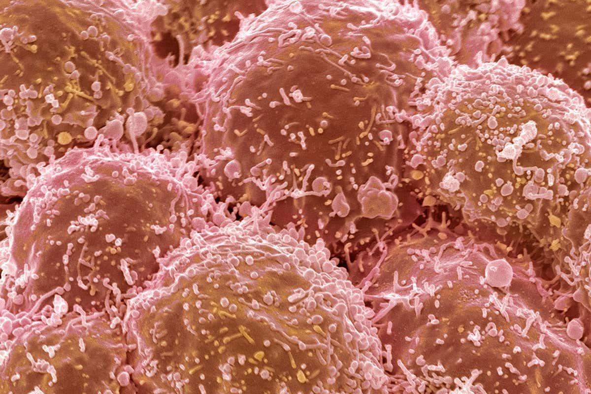 newscientist's tweet photo. Two children with cancer may have acquired tumour cells before birth https://t.co/pcHR2wUsBM https://t.co/VPvkHsHBck