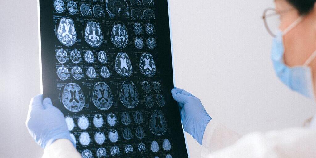 Ospedale San Camillo IRCCS Venezia (@scamillove) on Twitter photo Come prevenire il progressivo deterioramento delle abilità finanziare di un paziente con #decadimentocognitivo lieve?
Questo il focus dello studio condotto dal Laboratorio di #neuropsicologia del <a href="/SanCamilloIRCCS/">IRCCS San Camillo Research Hospital</a>
Leggi l'approfondimento al seguente post:
facebook.com/SanCamilloIRCC… Come prevenire il progressivo deterioramento delle abilità finanziare di un paziente con #decadimentocognitivo lieve?
Questo il focus dello studio condotto dal Laboratorio di #neuropsicologia del <a href="/SanCamilloIRCCS/">IRCCS San Camillo Research Hospital</a>
Leggi l'approfondimento al seguente post:
facebook.com/SanCamilloIRCC…