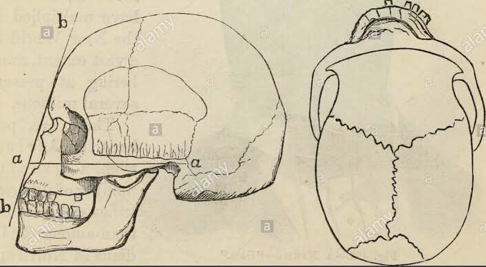 This is one of the things anthropologists use to determine if the skull is Afrikan or Eurasian.