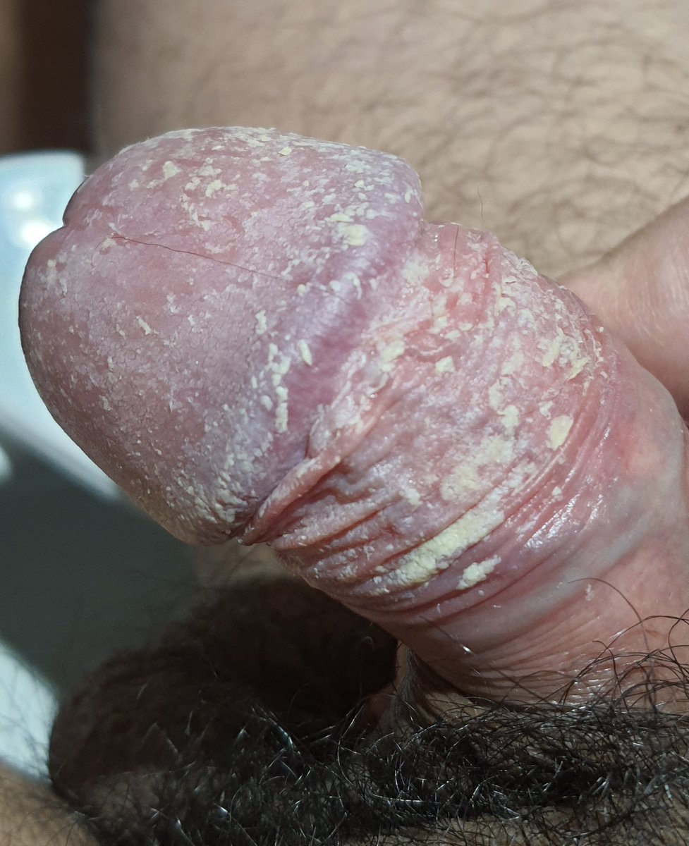 smegmakingmx's tweet photo. Día 9 #smegma #dickcheese #dirtydick #dirtycock #pausujo #cheiroderola #sebodemacho #quesodemacho #vergasucia #チンカス #包皮垢 #requesón https://t.co/n4ZkXpllCh