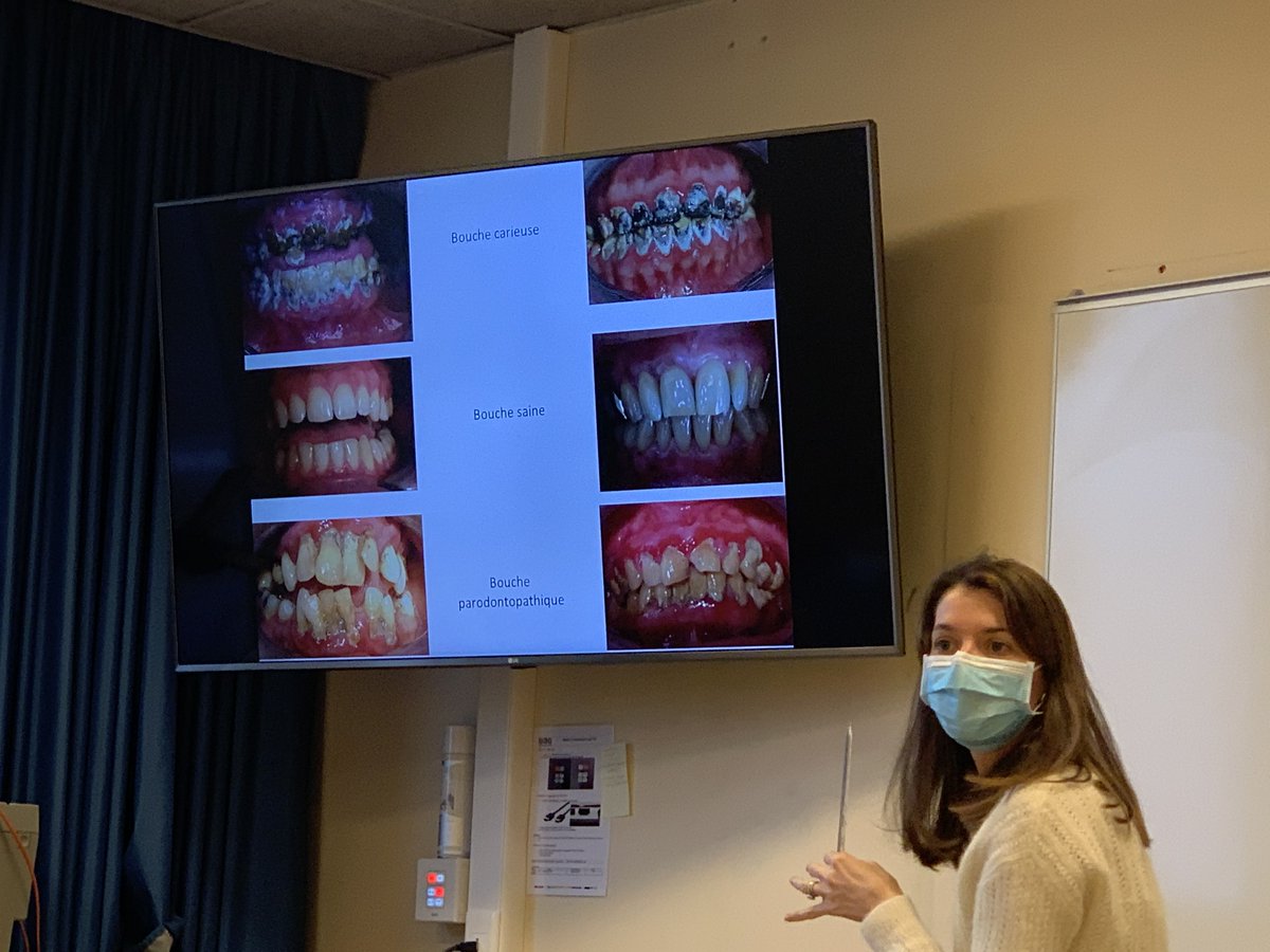 Fanny Basse presenting her M2 project on chronic periodontitis in patients of ICU: diagnostic performances of a point of care P. gingivalis test and correlation between the #dental microbiome on #VAP. CP-ICU study is coordinated by Pr Cécile Aubron and Pr <a href="/Sylvieb29/">Sylvie Boisramé</a>.