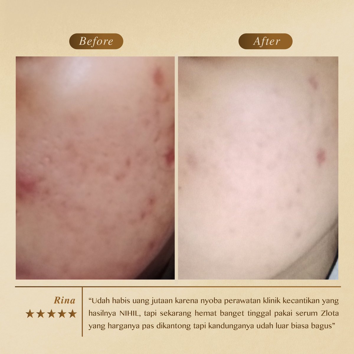 Racun Serum Auto Glowing Check! ✨👌

@Zlotaofficial sudah BPOM &amp; Halal 
Harga only 158K !

LINK : shp.ee/6n8fkn3