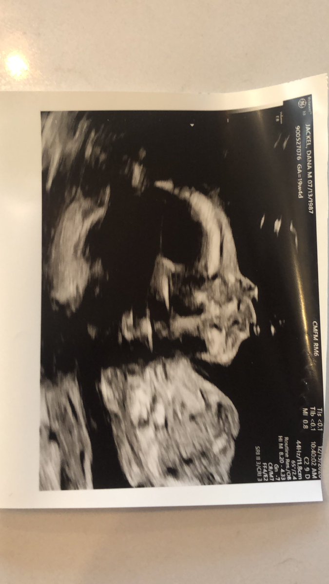 One more thing: his name was Alexander Robert Klemko. My son’s name will be Jack Alexander, after his great grandfather on his mother’s side who survived the Holocaust, and my dad.