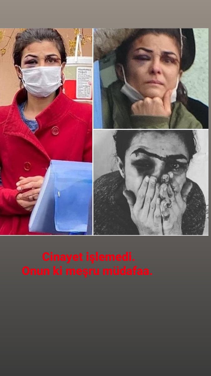 Bunun adı meşru müdafaa 
Öz savunma haktır.
Nefsi müdafaa şarttır.
Adam olacaksınız.
#melekipek
#MelekİpekSerbestBırakılsın
#melekipekicinadalet
#melekipeksucsuzdur