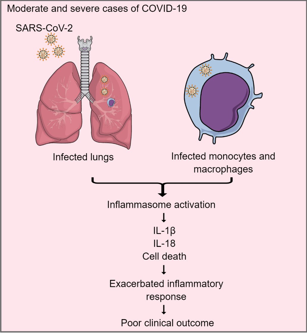 McHeyzer-Williams (@mmw_lmw) on Twitter photo #SARSCoV2_Infection | #Inflammasomes are activated and associated with COVID-19 severity in patients | Dario Zamboni <a href="/usponline/">USP - Universidade de São Paulo</a> <a href="/JExpMed/">Journal of Experimental Medicine</a> buff.ly/3a6znoG | #2020_ReCapDec #SARSCoV2_Infection | #Inflammasomes are activated and associated with COVID-19 severity in patients | Dario Zamboni <a href="/usponline/">USP - Universidade de São Paulo</a> <a href="/JExpMed/">Journal of Experimental Medicine</a> buff.ly/3a6znoG | #2020_ReCapDec