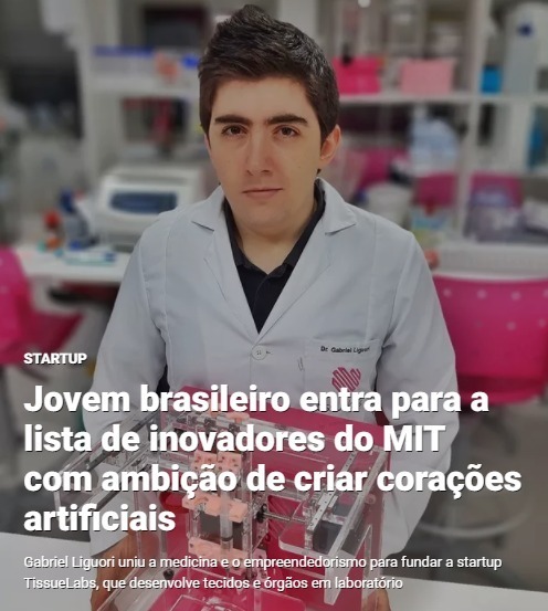 We are glad to be featured on Época Negócios' article today! Make sure to check it out through the link below:

epocanegocios.globo.com/Startup/notici…

#tissueengineering #biotech #startup #science #biology #technology #engineering