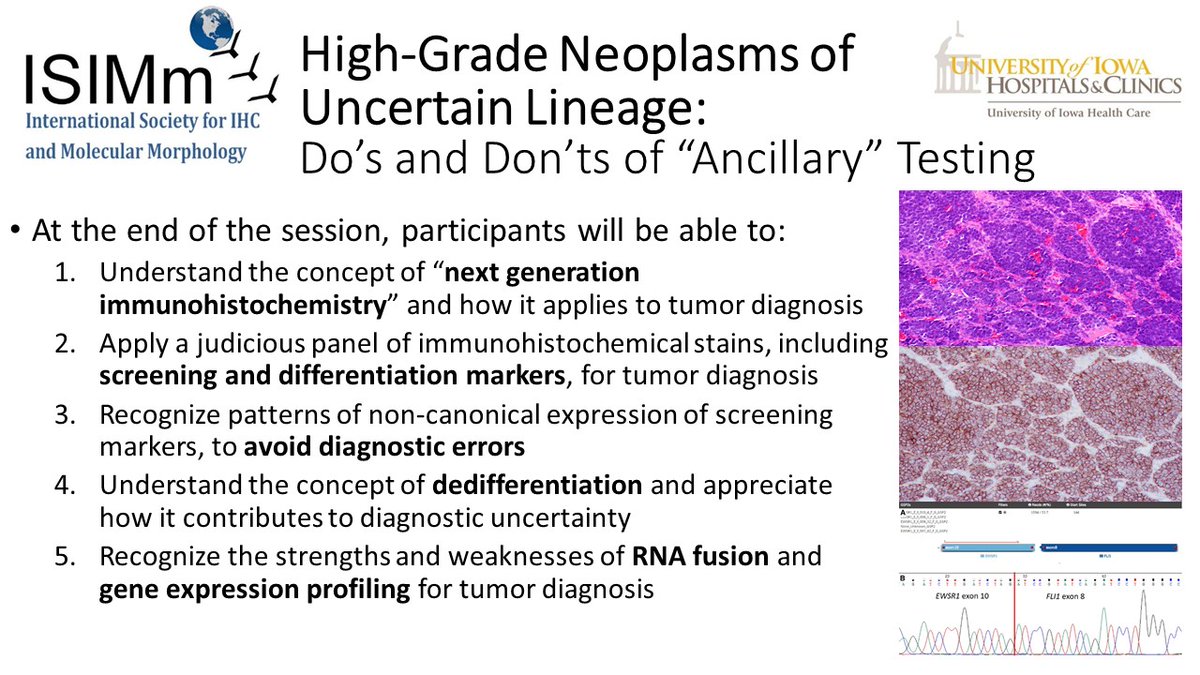 I'm a little bashful to do self-promotion😊😊😊, but I'm writing to invite everyone to my #Zoom webinar this Wednesday morning at 11 AM Eastern: High-Grade Neoplasms of Uncertain Lineage: Do's and Don'ts of "Ancillary" Testing.

Register in advance here: us02web.zoom.us/webinar/regist…