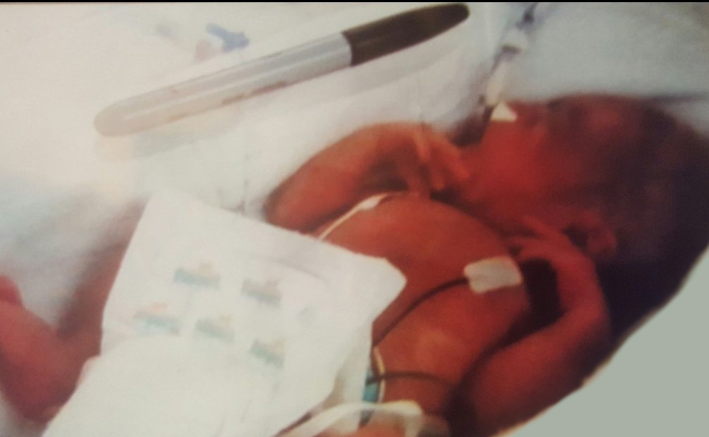 UIchildrens's tweet photo. Nine years ago while Jack Jaster was in our NICU, a nurse set a Sharpie next to him so his parents could tell from the photo just how small he was. With that gesture, a tradition was born. Happy birthday, #NICUgrad! 💛 https://t.co/xs1Fb2V5Ow