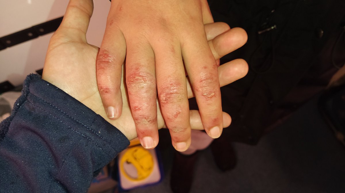 lidortahiva's tweet image. Cuando los niños/as de Cañada real dicen que tienen frío... ¡Emergencia ya!
#CanadaReal #ayuntamientomadrid