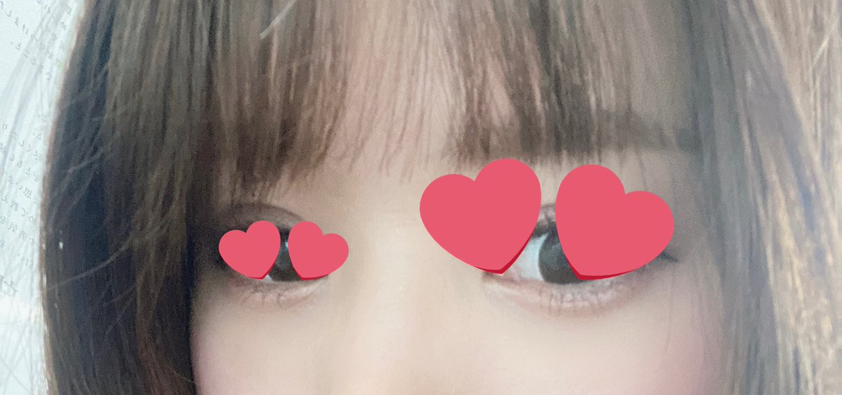 chu_biyo__'s tweet photo. ���の下のクマ取りしてから、2ヶ月弱経ちました👼もう何も気にならずに生活しています😳
アプリで撮るとこんな感じ🧸💞
1ヶ月くらいの時は凹みがすごく気になっていたけど、気にならなくなった😳
ちなみに3週間〜1ヶ月過ぎが一番ゾンビみたいに目の下暗くなって前とは違うクマがあるみたいに見えた😱 https://t.co/KGiIZUYUYX