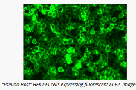 arneschulz1's tweet photo. @tecasc 
SARS-CoV-2 Pseudovirus Entry Assay, by Montana Molecular. No BSL-2 required.
https://t.co/ANArs4u1MZ https://t.co/hfwMpnHcSk