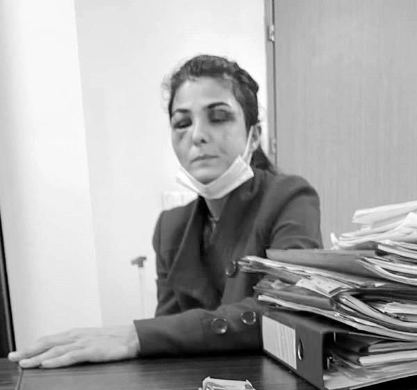 Melek İpek’in küçük kızı: "Yaşasın babam artık gelmeyecek, dayak yemeyeceğiz."

#MelekİpekİcinAdalet #Melekİpek