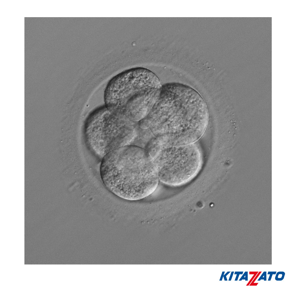KitazatoIVF's tweet photo. In our latest #KitazatoQuiz we discussed about performing AH on day 3 or day 5/6 for a blastocyst biopsy; if you perform the AH on day 3, do you think is better to change the culture medium or not?
#kitazato #kitazatoivf #vitrification #Embryology #ivfhero https://t.co/KtURak4ueh