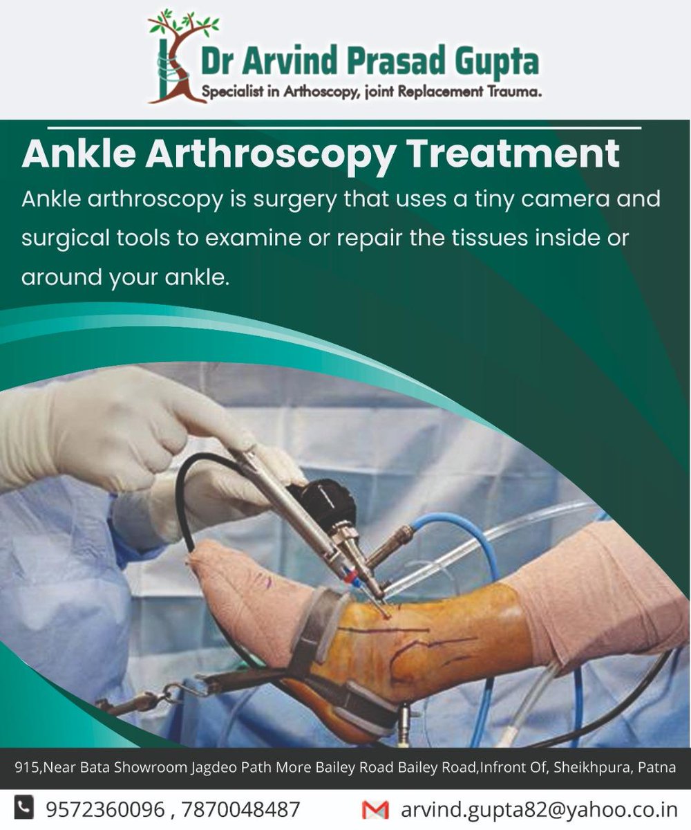 Ankle Arthroscopy Treatment

Ankle arthroscopy is surgery that uses a tiny camera and surgical tools to examine or repair the tissues inside or around your ankle.

Contact Dr. Arvind - Ligament Joint and Arrhritis Clinic
visit website🌐 drarvindprasadgupta.com

#AnkleArthroscopy