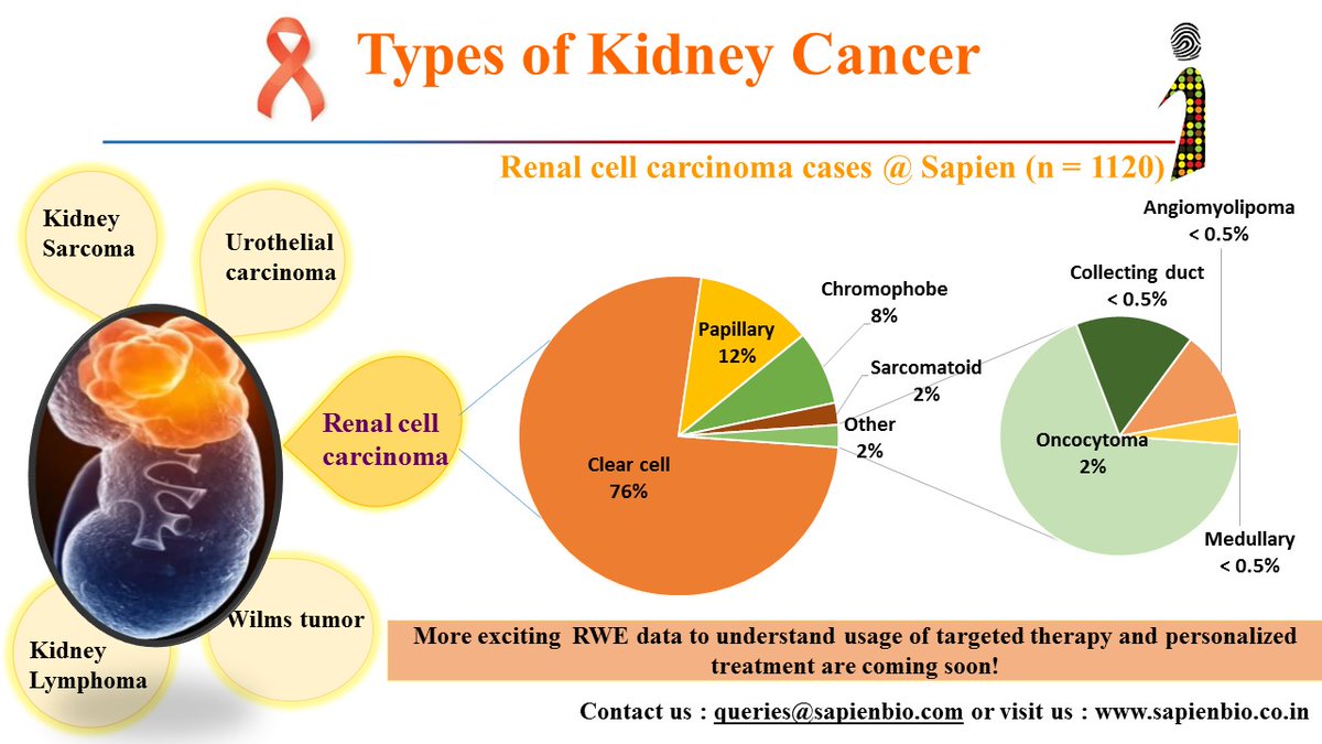 Sapienbio2012's tweet photo. Types of Kidney Cancer
https://t.co/Q8nw0lTPMk
#KidneyCancerAwareness #RareCancertype #Sapien #FFPE #Biobank #CancerCure #CancerResearch #Personalizedtreatment #CancerBiology #CancerResearchInstitute #CancerCouncil #FightCancerGlobal #KidneyCancerAssociation #KidneyCan #KCAN https://t.co/hG3uLapwdA