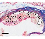MSU_EGR's tweet photo. Research by Biomedical Engineer Bryan Smith @michiganstateu was named the top study of 2020 @OriginateHealth. “A nanoparticle that eats the plaque responsible for heart attacks” garnered the most views for the past 12 months on its site. https://t.co/Rkzyk60zbD https://t.co/kLsdUMp0HF