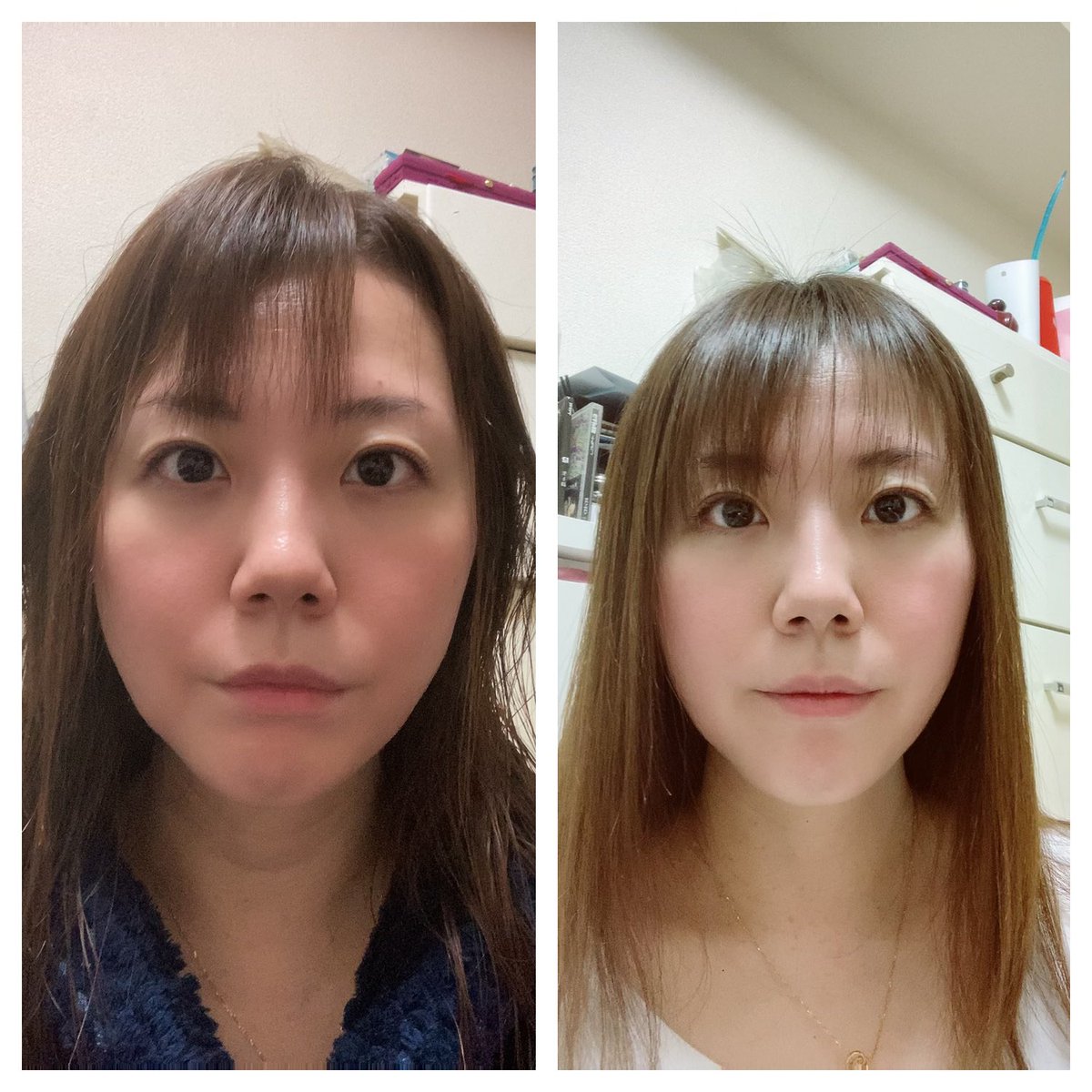 ニコベルト使い始めて1ヶ月 どうでしょう？？変わってないなー 