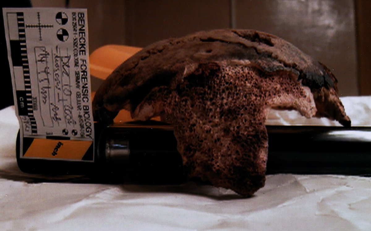 weird_hist's tweet photo. The Russians claim that they have a section of Hitler's skull stored in a Moscow vault. https://t.co/qxiwVLtYBr