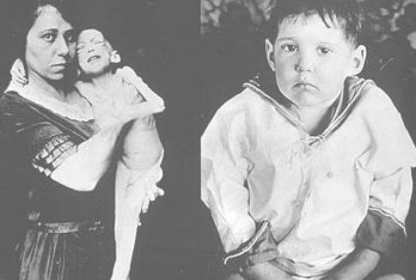 tip_site's tweet photo. 11th January 1922

99 years to the yesterday....

The first dose of #Insulin was administered 

A 14 year old boy called Leonard Thompson

And life was never the same again for so many many people 

What a moment in the history of science Petri dish #Insulin #Diabetes https://t.co/Qsuzovfwvw