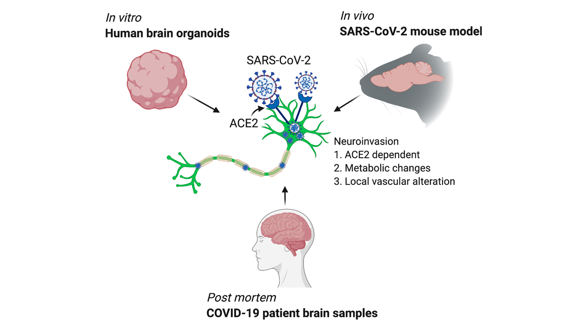 Neurological symptoms are frequently observed in #COVID19. Using three independent approaches - mouse model, human brain organoid and autopsies of COVID-19 patients, @ericsongg @virusesimmunity team demonstrates evidence of #SARSCoV2 neuroinvasion. bit.ly/38BjLbA