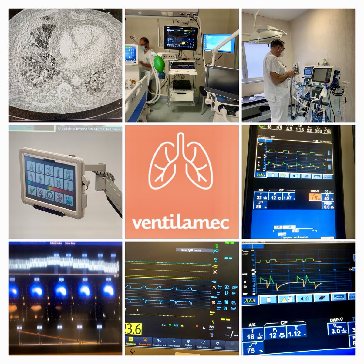 A punto de empezar el curso de Fundamentos de Ventilación Mecánica Online. Edición 2021.
Aún a tiempo de apuntaros.
#SoMe4MV <a href="/semicyuc/">SEMICYUC</a>   <a href="/lasecip/">SECIP</a> @somiama