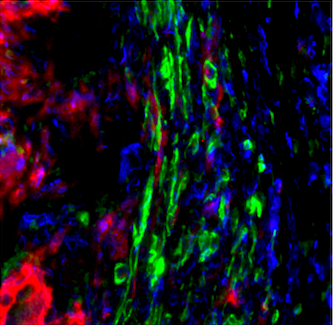 Stephanie Evans (@_stephanieevans) on Twitter photo Super happy that this paper has been published, joint collaboration by the <a href="/KirschnerDenise/">Denise Kirschner, Ph.D</a> lab, <a href="/Mattila_TB_Lab/">Josh Mattila</a> funded by <a href="/ImmunologyAAI/">The American Association of Immunologists (AAI)</a> intersect fellowship.
pubmed.ncbi.nlm.nih.gov/33370784/
#science #immunology #ploscompbio #multidiciplinary #research Super happy that this paper has been published, joint collaboration by the <a href="/KirschnerDenise/">Denise Kirschner, Ph.D</a> lab, <a href="/Mattila_TB_Lab/">Josh Mattila</a> funded by <a href="/ImmunologyAAI/">The American Association of Immunologists (AAI)</a> intersect fellowship.
pubmed.ncbi.nlm.nih.gov/33370784/
#science #immunology #ploscompbio #multidiciplinary #research