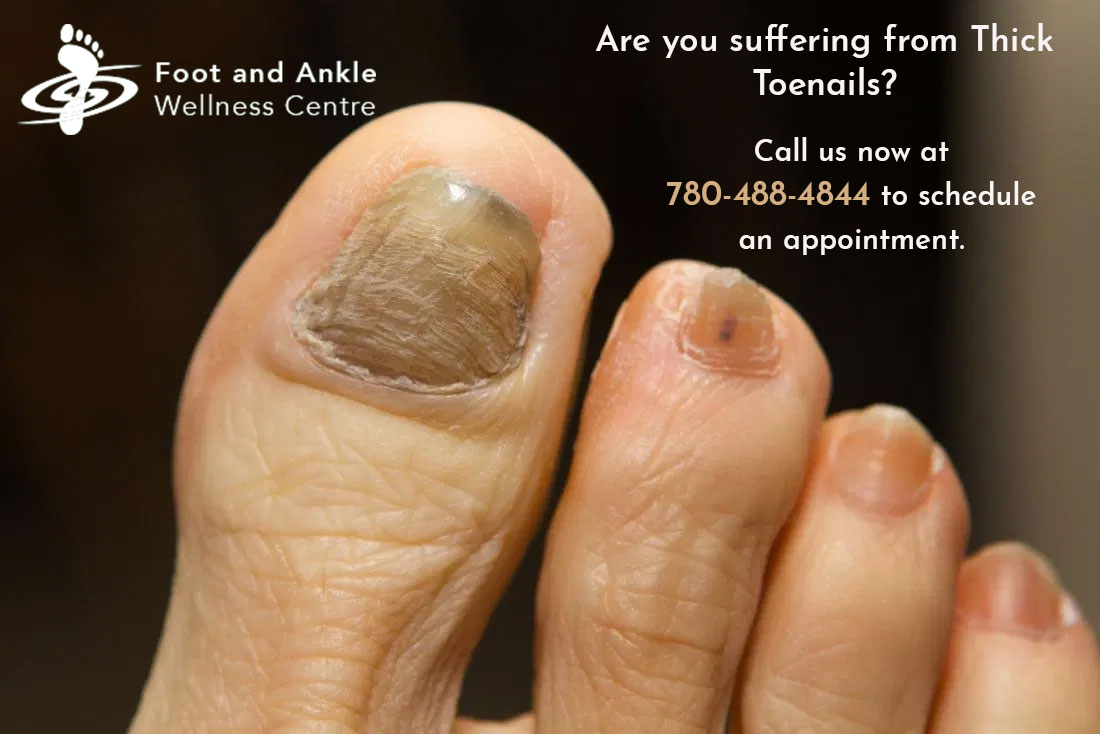 EdmontonFootDoc tweet picture