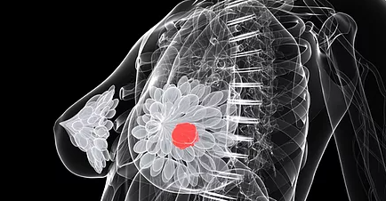 WimvanDalen's tweet image. Bezoek de site alcoholenborstkanker: alcoholenborstkanker.nl