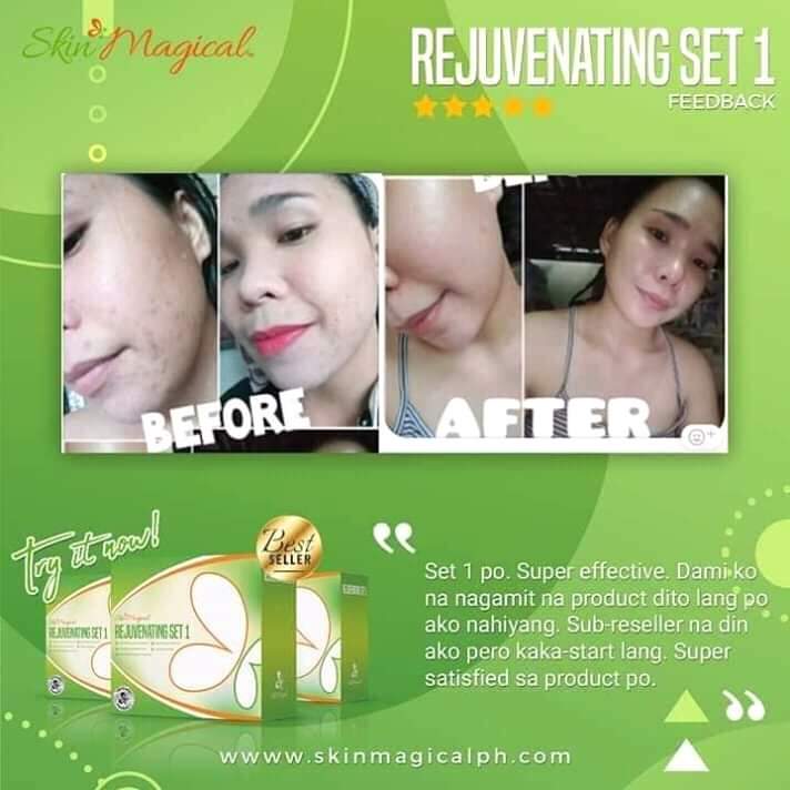 LatugaAngeline's tweet photo. Skin Magical Feedback❗
Bakit ka mgtitiis kung meron namang Solusyon😊👊
Achieve beauty that is simple and affordable😍💯✨✨
#SkinMagical Rejuvenating Set 1

Grab yours now 😍😍
#SkinMagical
@_skinmagical 
@ghiepangilinan https://t.co/K7kHaS5I3d
