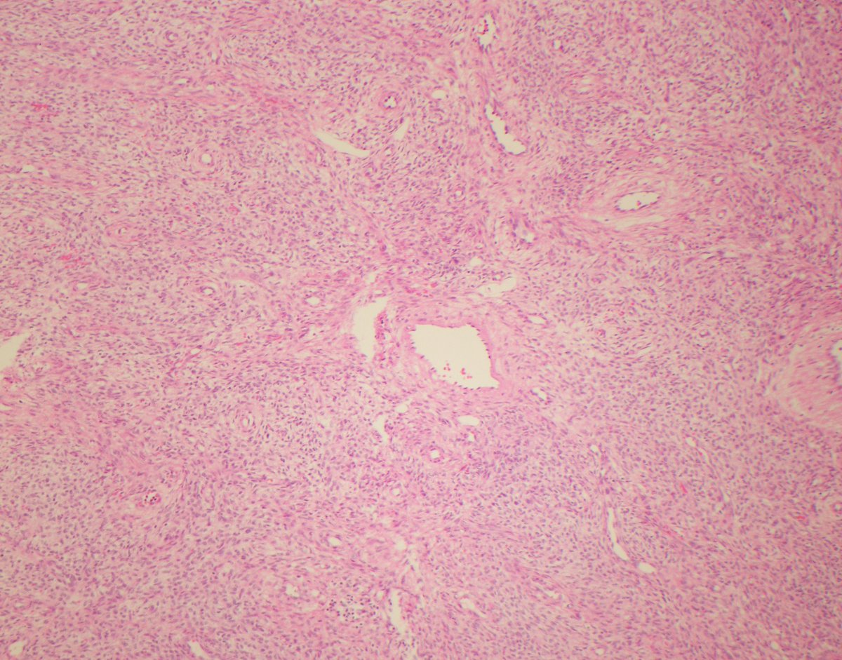 CaDxPath tweet picture