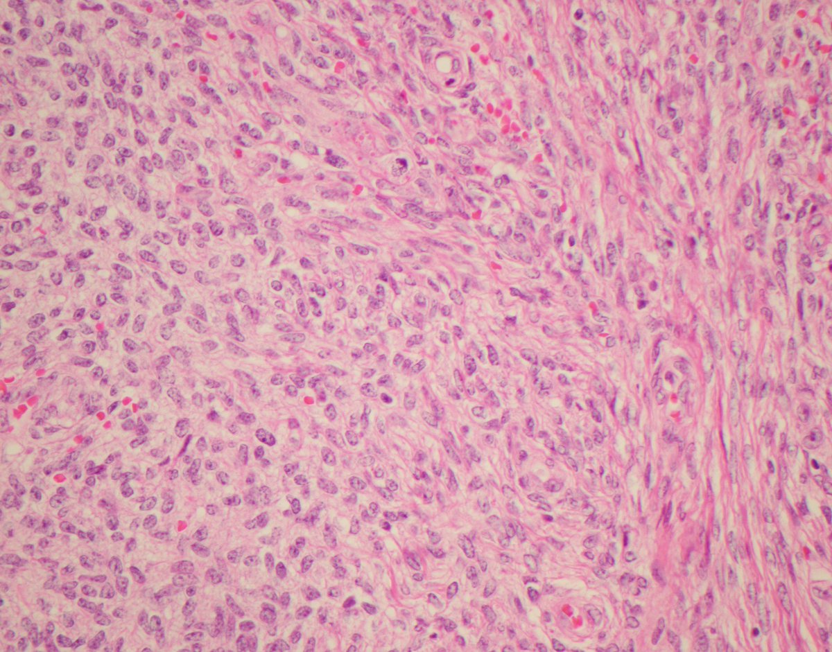CaDxPath tweet picture
