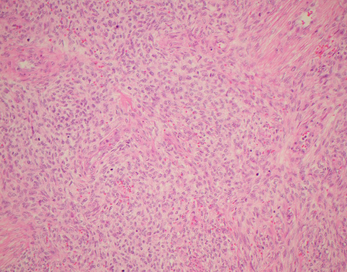 CaDxPath tweet picture