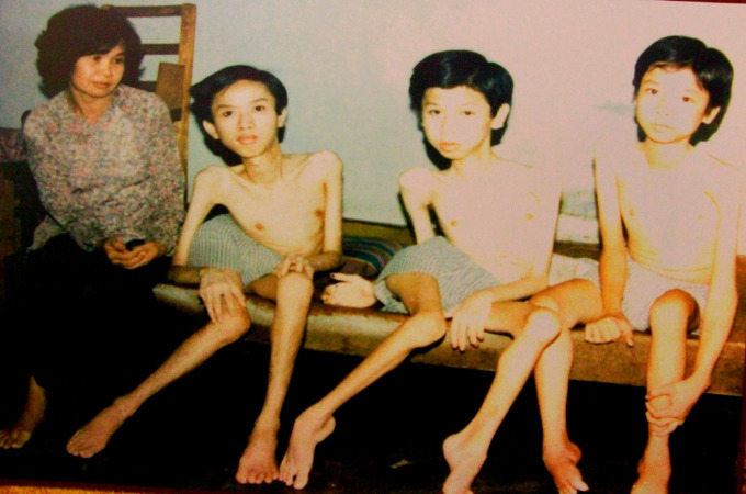 A_Saleh313's tweet photo. @SecPompeo #Agent_Orange is widely known for its use by the U.S. military as part of its chemical warfare program Operation Ranch Hand, during the #Vietnam War from 1961 to 1971.
Up to four million people in Vietnam were exposed to the defoliant.
#ShutUpPompeo https://t.co/jqovyQG06u