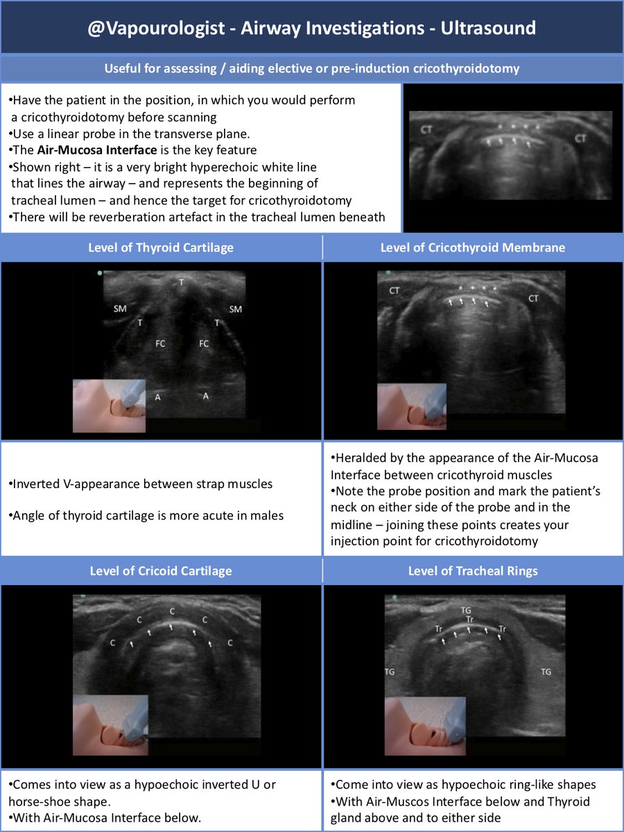  #JanuAirway Remember USS can aid with tracheostomy – here’s the  #OnePager from Day 5!  @jeffgadsden  @KiJinnChin  @EMARIANOMD  @amit_pawa There’s much more to tracheostomy care – here's an amazing resource from Portsmouth ICU  http://www.portsmouthicu.com/resources/2017-06-30-TracheHandbook(2017).pdf 8/9