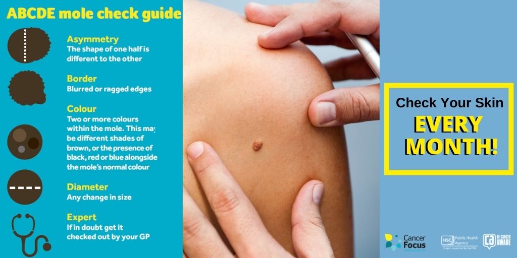 CancerFocusNI's tweet photo. Every day 11 people in #NorthernIreland are diagnosed with #skincancer. Check your skin monthly! You only get one skin. Look after it. If you notice any changes, visit your GP asap. #Earlydetection of skin cancer saves lives! #Loveyourskin #Beskinaware #BeUVAware @publichealthni https://t.co/OSsJgAVsb5